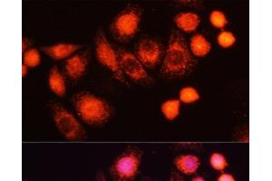 Immunofluorescence analysis of HeLa cells using HRAS Polyclonal Antibody at dilution of 1:100 (40x lens). (HRAS antibody)