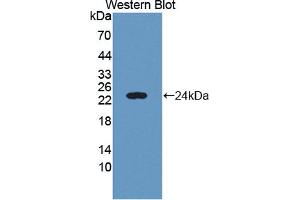Western blot analysis of the recombinant protein. (C6orf150 antibody  (AA 225-407))