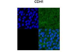 Sample Type :  Rat FRTL-5 cells   Primary Antibody Dilution :   1:100   Secondary Antibody :  Goat anti-rabbit-FITC   Secondary Antibody Dilution :   1:1000  Color/Signal Descriptions :  1A: DAPI, 2B: phase contrast, 2A: CDH1, 2B: DAPI + CDH1  Gene Name :  CDH1  Submitted by :  Risheng Ma, MSSM