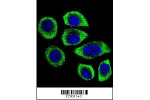 Confocal immunofluorescent analysis of PIP5KL1 Antibody with U-251MG cell followed by Alexa Fluor 488-conjugated goat anti-rabbit lgG (green). (PIP5KL1 antibody  (N-Term))