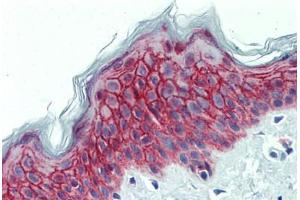 Human Skin: Formalin-Fixed, Paraffin-Embedded (FFPE) (GALR2 antibody  (AA 212-277))