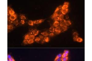 Immunofluorescence analysis of A431 cells using LAMC2 Polyclonal Antibody at dilution of 1:100 (40x lens).