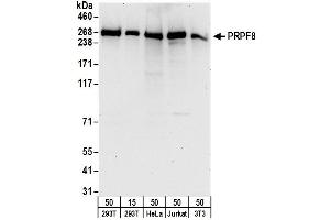 Western Blotting (WB) image for anti-PRP8 Pre-mRNA Processing Factor 8 (PRPF8) (AA 850-900) antibody (ABIN7454570)