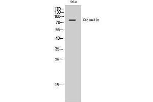 Western Blotting (WB) image for anti-Cortactin (CTTN) (Ser338) antibody (ABIN3184049) (Cortactin antibody  (Ser338))