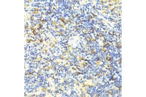 Immunohistochemistry of paraffin-embedded mouse spleen using ARRB1 antibody.