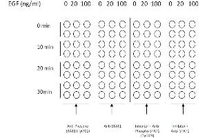 Image no. 4 for Signal Transducer and Activator of Transcription 1, 91kDa (STAT1) ELISA Kit (ABIN1981837)