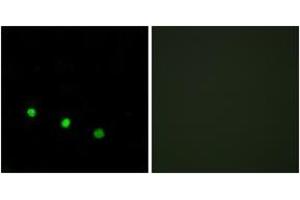 Immunofluorescence analysis of HuvEc cells treated with EGF 200nM 5', using FosB (Phospho-Ser27) Antibody. (FOSB antibody  (pSer27))