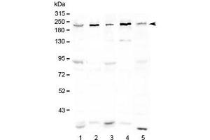 Western blot testing of human 1) HeLa, 2) COLO320, 3) 293T, 4) Jurkat and 5) mouse testis lysate with ASXL1 antibody at 0. (ASXL1 antibody)