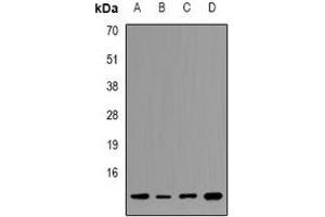 Western blot analysis of Histone H2B expression in K562 (A), HEK293T (B), NIH3T3 (C), mouse kidney (D) whole cell lysates. (Histone H2B antibody  (N-Term))