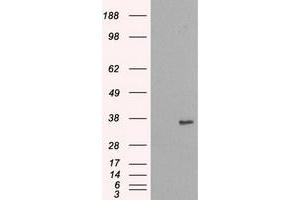 Image no. 2 for anti-NIMA (Never in Mitosis Gene A)-Related Kinase 6 (NEK6) antibody (ABIN1499685) (NEK6 antibody)