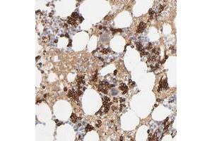 Immunohistochemical staining of human bone marrow with SPTB polyclonal antibody  shows strong cytoplasmic positivity in bone marrow poietic cells.