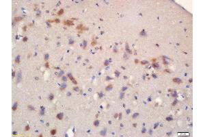 Formalin-fixed and paraffin embedded rat brain labeled with Rabbit Anti-mTOR (Ser2481) Polyclonal Antibody, Unconjugated 1:200 followed by conjugation to the secondary antibody and DAB staining (MTOR antibody  (pSer2481))