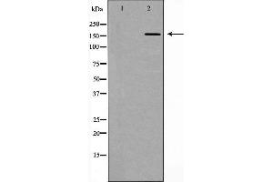 Western blot analysis of extracts of mouse lung, using DLC1 antibody. (DLC1 antibody  (N-Term))
