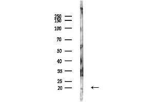 Western blot analysis of lysates from LoVo cells(heat-shock,45 min treatment), using IMMP1L Antibody at 1/1000 dilution.