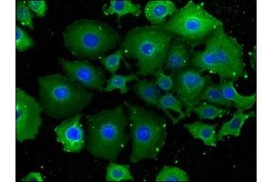 Immunofluorescence staining of A549 cells with ABIN7151958 at 1:100, counter-stained with DAPI. (Epsin 2 antibody  (AA 15-300))