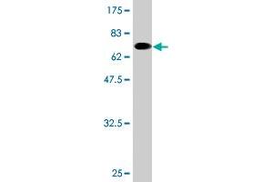Western Blot detection against Immunogen (69. (TCN2 antibody  (AA 1-400))