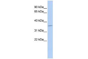 SULT1C4 antibody used at 1 ug/ml to detect target protein. (SULT1C4 antibody  (Middle Region))
