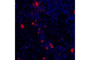 Immunofluorescence (IF) image for anti-Granzyme B (GZMB) (AA 19-247) antibody (ABIN7449554)