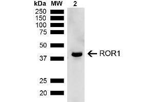 Western blot analysis of Rat Kidney showing detection of ~43 kDa ROR1 protein using Rabbit Anti-ROR1 Polyclonal Antibody (ABIN5667776).