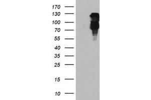 HEK293T cells were transfected with the pCMV6-ENTRY control (Left lane) or pCMV6-ENTRY FBXO21 (Right lane) cDNA for 48 hrs and lysed. (FBXO21 antibody)