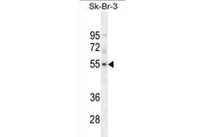 WDR21B Antibody (C-term) western blot analysis in SK-BR-3 cell line lysates (35 µg/lane). (DCAF4L1 antibody  (C-Term))