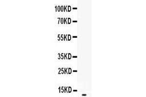 Western blot analysis of CXCL2 expression in recombinant rat CXCL2 protein 0. (CXCL2 antibody  (AA 32-100))