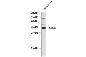 Western blot analysis of extracts of Mouse liver using C1QB Polyclonal Antibody at dilution of 1:1000. (C1QB antibody)