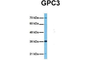 Host:  Rabbit  Target Name:  GPC3  Sample Tissue:  Human Adult Placenta  Antibody Dilution:  1. (Glypican 3 antibody  (Middle Region))