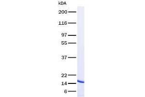 Validation with Western Blot (TNFRSF10A Protein)
