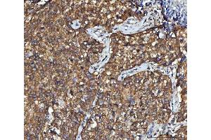 IHC analysis of CBR1 using anti-CBR1 antibody (ABIN7600015). (CBR1 antibody  (AA 14-262))