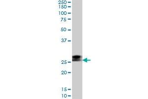 Western Blotting (WB) image for anti-Ring Finger Protein 141 (RNF141) (AA 141-230) antibody (ABIN599236) (RNF141 antibody  (AA 141-230))