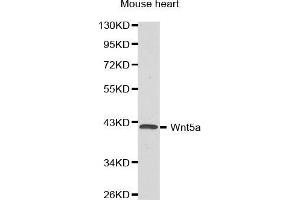 Western Blotting (WB) image for anti-Wingless-Type MMTV Integration Site Family, Member 5A (WNT5A) (AA 101-380) antibody (ABIN3023003) (WNT5A antibody  (AA 101-380))