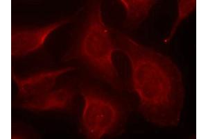 Immunofluorescence staining of methanol-fixed Hela cells using BIM(Phospho-Ser69) Antibody. (BIM antibody  (pSer69))