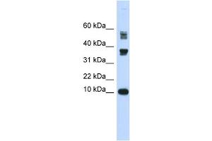 WB Suggested Anti-FABP3 Antibody Titration:  0.