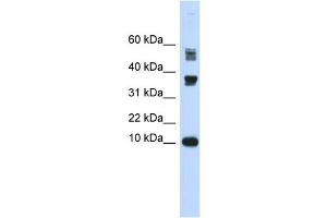 WB Suggested Anti-FABP3 Antibody Titration:  0. (FABP3 antibody  (Middle Region))