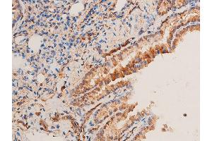 Immunohistochemistry (IHC) image for anti-Checkpoint Kinase 1 (CHEK1) (pSer296) antibody (ABIN6256251)