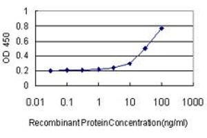 Detection limit for recombinant GST tagged B3GALT2 is approximately 3ng/ml as a capture antibody. (B3GALT2 antibody  (AA 324-422))