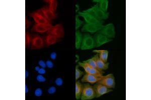 ABIN6259315 and ABIN6274430 staining Hela cells(45 min of heat-shock) by IF/ICC. (RGAG1 antibody  (C-Term))
