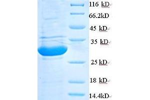 phospholipase A2, Group V (PLA2G5) (AA 21-137) protein (His tag) expressed in E.