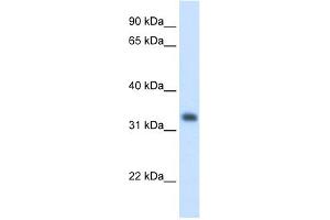 WB Suggested Anti-HMGCL Antibody Titration:  1. (HMGCL antibody  (N-Term))