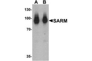 Western blot analysis of SARM in human kidney tissue lysate with SARM Antibody  at (A) 1 and (B) 2 ug/mL. (SARM1 antibody  (N-Term))