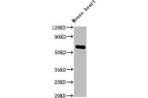 Western Blotting (WB) image for anti-Carboxylesterase 1C (CES1C) (AA 19-550) antibody (ABIN7177073)