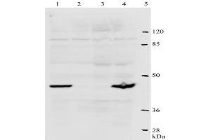 Western-Blot analysis of HPV-18 E2 protein. (Human Papilloma Virus 18 E2 (HPV-18 E2) (AA 1-83) antibody)