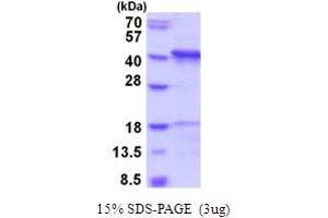 SDS-PAGE (SDS) image for Cathepsin L1 (CTSL1) (AA 18-333) protein (His tag) (ABIN5854107) (Cathepsin L Protein (AA 18-333) (His tag))