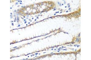 Immunohistochemistry of paraffin-embedded Human stomach using PPP4R1 Polyclonal Antibody at dilution of 1:100 (40x lens). (PPP4R1 antibody)