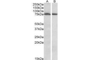 ABIN570996 (1µg/ml) staining of Mouse (A) and Rat (B) Brain (35µg protein in RIPA buffer). (STK39 antibody  (Internal Region))