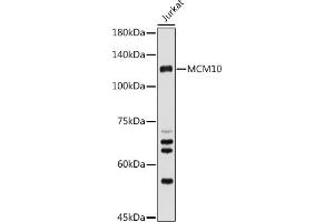 Western blot analysis of extracts of Jurkat cells, using MCM10 antibody (ABIN6129654, ABIN6143639, ABIN6143641 and ABIN6223024) at 1:500 dilution. (MCM10 antibody  (AA 616-875))