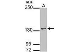 Image no. 2 for anti-Autism Susceptibility Candidate 2 (AUTS2) (AA 524-770) antibody (ABIN467523) (AUTS2 antibody  (AA 524-770))