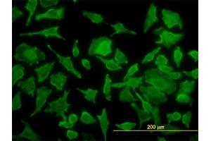 Immunofluorescence of monoclonal antibody to TPT1 on HeLa cell. (TPT1 antibody  (AA 35-138))