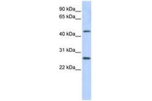 Image no. 1 for anti-PRAME Family Member 10 (PRAMEF10) (AA 396-445) antibody (ABIN6741262) (PRAMEF10 antibody  (AA 396-445))